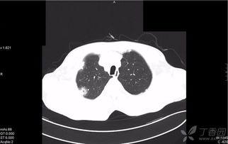 ct弗莱彻个人资料,揭秘这位杰出人物的传奇人生